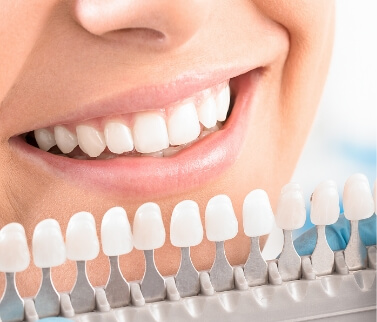 Close up of shade guide next to a smile