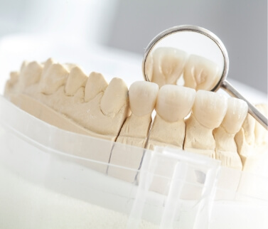 Dental mirror resting next to a model of a row of teeth