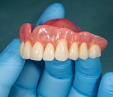 Partial denture shown against white background