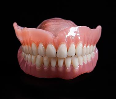 Illustration of implant dentures for lower arch
