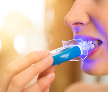 Patient in Worcester using take-home teeth whitening