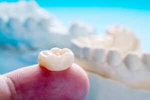 Person holding a dental crown